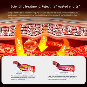 Alat Pijat Pelindung Jantung <span class=keywords><strong>Laser</strong></span>, Perangkat Terapi Pelindung Jantung Semikonduktor untuk Kardiovaskular dan Serebrovasular - Product Image 2