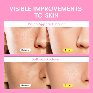 Leche Limpiadora 5 en 1 Personalizada, Súper Hidratante e Iluminadora, 50g, para Todo Tipo de Piel, Uso Diario - Product Image 3