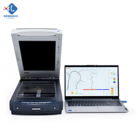 Lanende Root Analyzer Equipment with 1 Year Warranty 220V High Accuracy 0.5mm for Root Analysis Testing