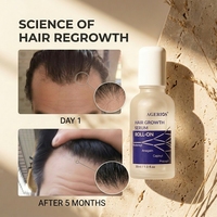 Sérum revitalisant pour le cuir chevelu avec Redensyl et Capixyl pour l'activation des follicules, essence anti-chute et repousse des cheveux, ODM