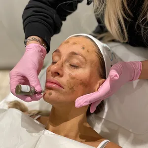 Kit de Algas Bio Alidina de la Mejor Calidad, Espículas de Esponja de Algas, Rejuvenecimiento Efectivo, Eliminación de Acné y Manchas Oscuras, Líneas Finas y Arrugas - Product Image 1