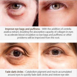 Glamor crocodile's fur repair scar gel treatment scar removal puffiness for eyes cream facial - Product Image 3