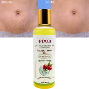 Huile de massage corporelle puissante et <span class=keywords><strong>efficace</strong></span> pour éliminer les vergetures, réparer la peau, raffermir et améliorer l'élasticité. - Product Image 1