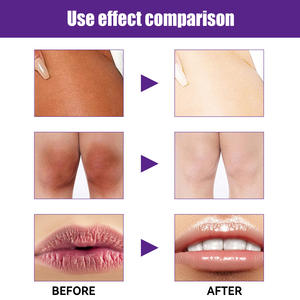 Crème de base éclaircissante pour le visage 14 jours crème décolorante de marque privée ensemble de blanchiment de la peau foncée pour les personnes noires - Product Image 3