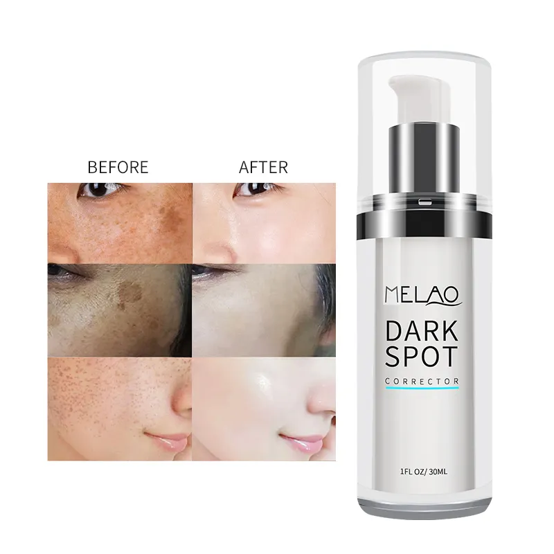 Private Label Organic Whitening Brightening Skin Repair siero coreano viso viso siero per la rimozione delle macchie scure