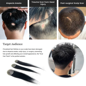 Parche de Cabello Humano Remy con Cinta Adhesiva, Mini Parche Capilar de 1.6*1.6, 1.2*1.2, 1*1, 6 Pulgadas, para <span class=keywords><strong>Alopecia</strong></span> <span class=keywords><strong>Areata</strong></span> y <span class=keywords><strong>Alopecia</strong></span> Androgénica - Product Image 2