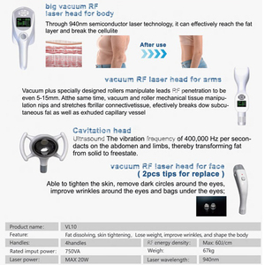 Rodillo de Vacío de Alta Calidad para Masaje Corporal, Dispositivo de Lifting Facial, Máquina Adelgazante - Product Image 6