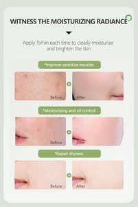 Gel de Aloe Vera Natural Calmante para Después del Sol, Marca Blanca, para Rostro y Cuerpo, Gel de Aloe Vera Puro Hidratante para <span class=keywords><strong>la</strong></span> Piel - Product Image 5