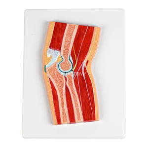 Modelo Anatómico Seccional de Rodilla Humana con <span class=keywords><strong>Menisco</strong></span>, de PVC, para Enseñanza, Entrenamiento <span class=keywords><strong>y</strong></span> Comunicación con Pacientes - Product Image 1