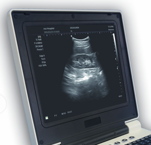 DMU03 Ecógrafo Médico Portátil de 12.1 Pulgadas, <span class=keywords><strong>Precio</strong></span> Económico, Imágenes Nítidas para Obstetricia y Ginecología - Product Image 6