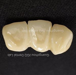 Prothèses dentaires en <span class=keywords><strong>zircone</strong></span> toutes les couronnes et ponts en céramique de haute qualité, bonne biocompatibilité et prix abordable - Product Image 1