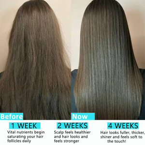 Prix de gros : Gommes capillaires au collagène et à la biotine avec vitamine B6 – Complément de biotine pour une peau saine et des cheveux et des ongles forts - Product Image 4