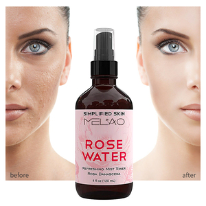 Tonique Visage Bio en Spray Hydratant Naturel Brume Faciale <span class=keywords><strong>Beauté</strong></span> <span class=keywords><strong>Rose</strong></span> Hydratant pour Adultes Femme Peau du Visage - Product Image 1
