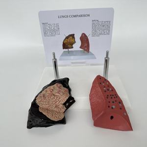 Modelo de patología pulmonar humana para ciencias médicas: modelo de enfermedad pulmonar, modelo de enfermedad orgánica, modelo antidrogas - Product Image 5
