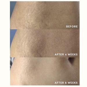 Aceite de estrías natural con jojoba Camellia Japonica esencial elimina cicatrices eliminación posparto estrías aceites de masaje corporal - Product Image 3