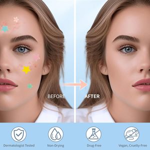 Nhãn hiệu riêng Hydrocolloid mụn vá dễ thương Sao Zit bao gồm mụn trứng cá tại chỗ điều trị đầy màu sắc tại chỗ dán với cây trà - Product Image 5