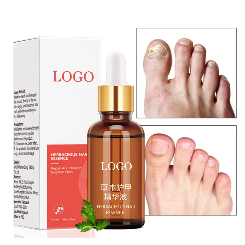 Herbal Fungal Nail Treatment Essential Oil Hand And Foot Whitening Toe Nail Fungus