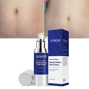 Crema Personalizada con Logotipo de Belleza Orgánica para <span class=keywords><strong>Embarazo</strong></span>, Antiarrugas, Blanqueadora, Suavizante, Hidratante, Elimina Cicatrices y Estrías - Product Image 1