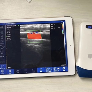 Appareil portable de détection et de diagnostic des tumeurs mammaires par échographie vasculaire sans fil à livraison rapide, pour dépistage du cancer du sein chez l'animal (vétérinaire) CU12 - Product Image 2