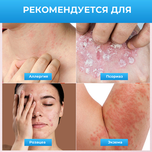 Crema y Ungüento Herbal para la Psoriasis y Dermatitis A60, con Vitamina E, 20g, 2 Años de Duración, para Aliviar la Picazón y el Dolor - Product Image 4