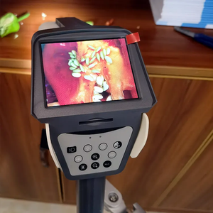 Colposcopio de Video para Examen Ginecológico C6HD de Alta Calidad, Endoscopio Vaginal, Colposcopio Ginecológico - Product Image 4