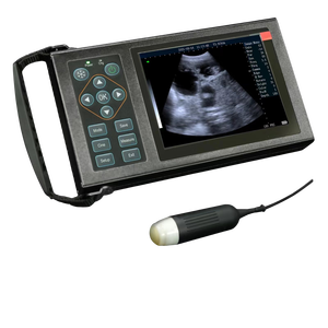 <strong>Portable</strong> <strong>Ultrasonic</strong> <strong>Scanner</strong> for Medical Diagnostic Imaging Reusable Feature - Product Image 1