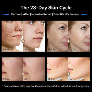 <span class=keywords><strong>Dermapen</strong></span> M9 al por Mayor, <span class=keywords><strong>Dr</strong></span>.Pen M9 con Batería Grande de 700mah, Dispositivo <span class=keywords><strong>Dermapen</strong></span> - Product Image 4