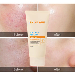 Crema Humectante Reparadora y Calmante para el Acné, Crema Blanqueadora para el Cuidado de la Piel, Crema de Aloe Vera al por Mayor - Product Image 3