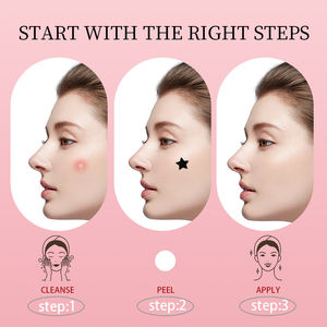 Patchs anti-acné bicolores en forme d'étoile |   Points de soin hydrocolloïdes noirs et blancs pour les boutons |   Couvre-imperfections invisible approuvé CE pour le visage - Product Image 5