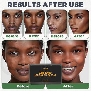 <span class=keywords><strong>Savon</strong></span> Noir Africain Solide Végétalien Enrichi au Beurre de Karité Marque Blanche – Exfoliation Douce <span class=keywords><strong>pour</strong></span> Tous Types de <span class=keywords><strong>Peau</strong></span>, Réduit les Imperfections et Unifie <span class=keywords><strong>le</strong></span> Teint - Product Image 2