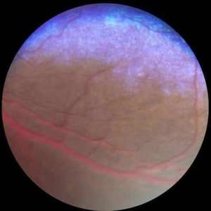 Tanınmış fabrikalardan veteriner kullanımı oftalmik cihazlar için taşınabilir yüksek çözünürlüklü <span class=keywords><strong>Fundus</strong></span> kameralar - Product Image 5