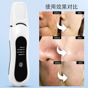 Waterproof Ultrasonic Skin Scrubber ABS Stainless Steel Face Spatula Facial Peeling <b>Pore</b> <b>Cleaner</b> - Product Image 4