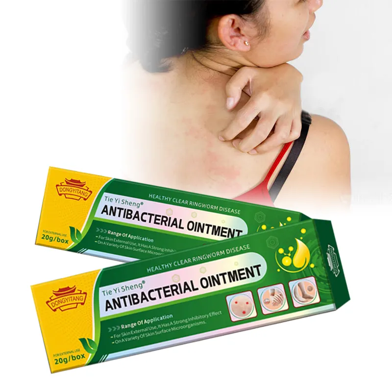 Free Sample Fungal Infection Skin Psoriasis Dermatitis Eczema Treatment Psoriasis Ointment