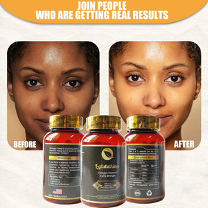 Eigen Merk Aangepaste Groothandel Glutathion <span class=keywords><strong>Whitening</strong></span> <span class=keywords><strong>Capsules</strong></span> Verminderen Melanine Antioxidant Glutathion <span class=keywords><strong>Whitening</strong></span> <span class=keywords><strong>Capsules</strong></span> - Product Image 4