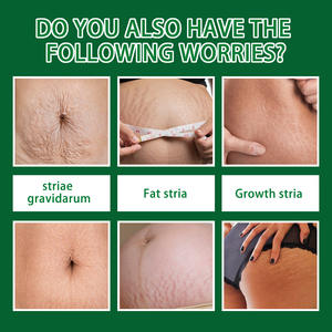 Spray de soin de la peau de haute qualité 30 ml Bestseller Spray hydratant pour le corps abdominal post-partum 100% extrait naturel Facilement absorbé - Product Image 2