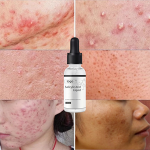 Soluzione per <span class=keywords><strong>Peeling</strong></span> Chimico BHA per Acne e Depigmentazione, Siero all'Acido Salicilico, <span class=keywords><strong>Peeling</strong></span> Chimico BHA per Esfoliazione Professionale del <span class=keywords><strong>Viso</strong></span> - Product Image 1