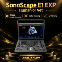 Dispositivo de Ultrasonido Veterinario Portátil Sonoscape E1 EXP V con Monitor HD de 15.6 Pulgadas, Película Protectora Impermeable, Doppler a Color