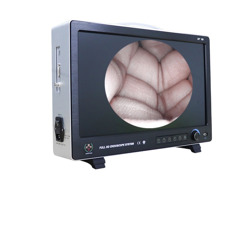 SUNNYMED SY P029 1 Flexible Endoscope