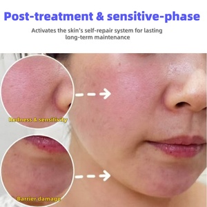 <span class=keywords><strong>Pommade</strong></span> au collagène humain recombinant de qualité médicale pour la réparation des dommages cutanés du <span class=keywords><strong>visage</strong></span>, cicatrisation des plaies, baume facial pour la réparation de la barrière cutanée après une intervention - Product Image 3