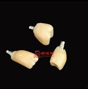 Couronnes d'implants avec excellente prothèse <span class=keywords><strong>dentaire</strong></span> plus confortables et plus belles que les prothèses et les ponts mobiles traditionnels - Product Image 5