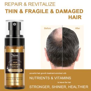 <span class=keywords><strong>Spray</strong></span> <span class=keywords><strong>tonico</strong></span> per la crescita dei capelli con biotina al rosmarino che ripara i capelli e si allontana - Product Image 4