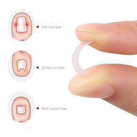 Autocollant de colle à ongles bandes correctrices orthèse de traitement des ongles Patch autocollant correcteur outils de pédicure outils de Correction des ongles d'orteils outil de pied