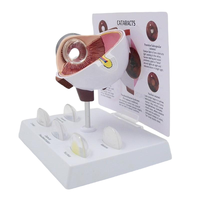 Modèle oculaire pathologique avec lentilles interchangeables pour la démonstration de la cataracte