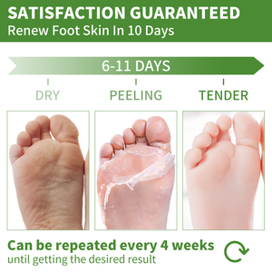 Máscara Exfoliante para <span class=keywords><strong>pies</strong></span>, <span class=keywords><strong>mascarilla</strong></span> exfoliante de marca privada, coreana, para reparación de talón, Spa - Product Image 4