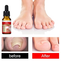 Solution de Soin des Ongles des Pieds de l'Usine de Guangzhou avec Hydratation et Nettoyage Doux pour les Ongles des Pieds