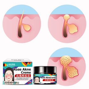 Crème de rosacée, assombrissement de l'acné, boutons, fosses d'acné, marques d'acné, crème, crème nettoyante - Product Image 4