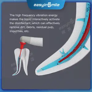 Easyinsmile brevetto endodontico attivatore per la clinica dentale