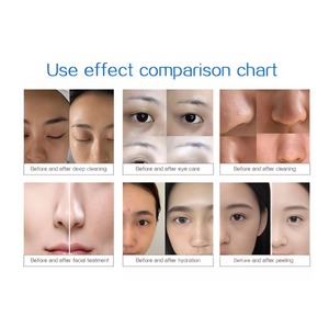 Appareil de beauté professionnel pour le visage avec technologie haute fréquence pour le soin du corps et du nez, traitement à jet d'oxygène, conception sur pied - Product Image 2