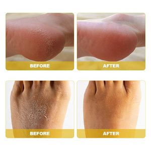 Spray exfoliant instantané pour les <span class=keywords><strong>pieds</strong></span> Spray exfoliant pour les <span class=keywords><strong>pieds</strong></span> à la noix de coco qui élimine les peaux mortes, exfoliant et callosités sur les <span class=keywords><strong>pieds</strong></span> - Product Image 3