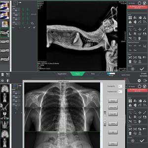Detector de Panel Plano de Radiografía <span class=keywords><strong>Digital</strong></span> Inalámbrico de 17x17 Pulgadas con Mango, Máquina de Rayos X Portátil para Clínica y Hospital - Product Image 2